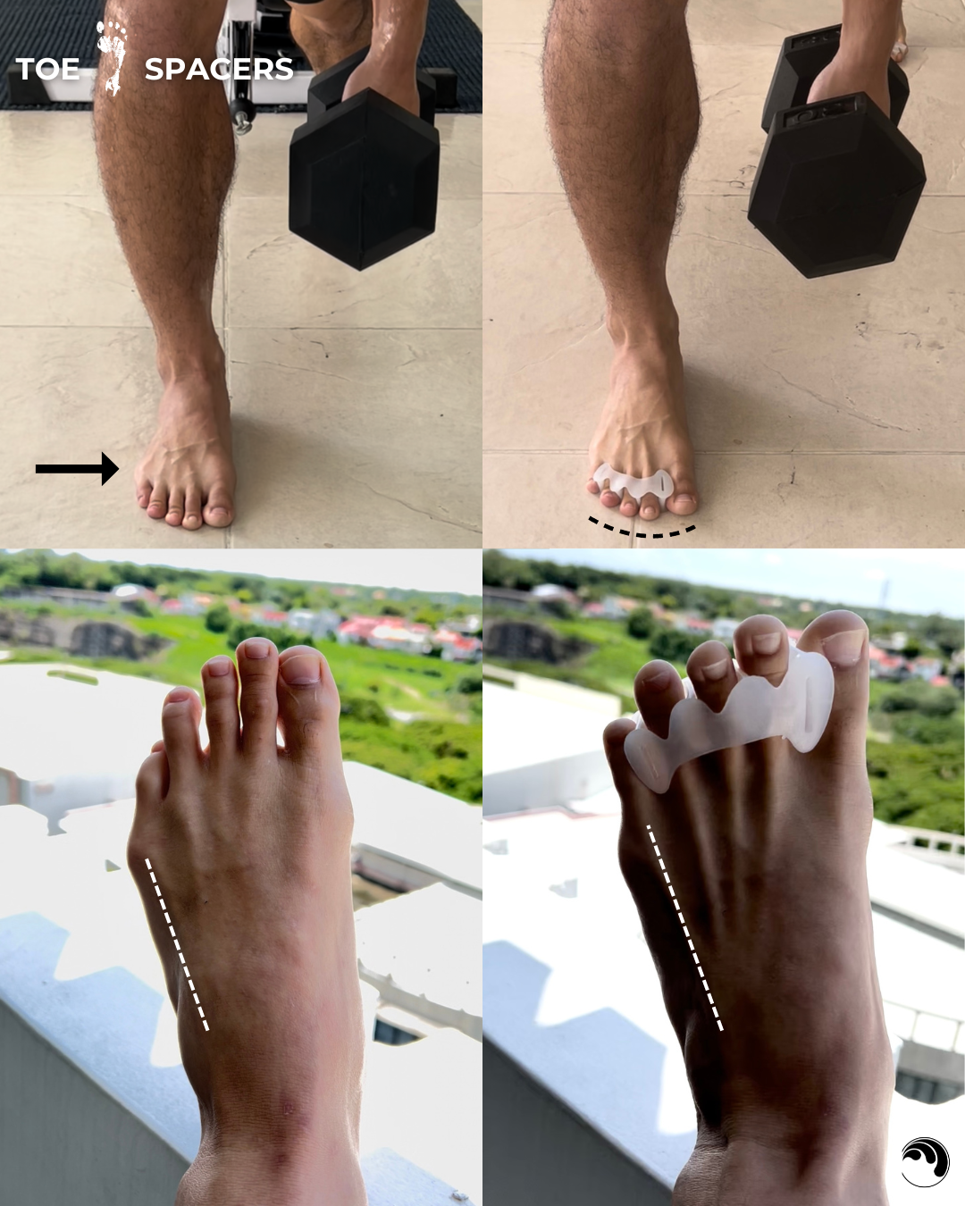 Toe Spacers (Pair)